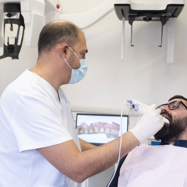 Scansione-Intraorale